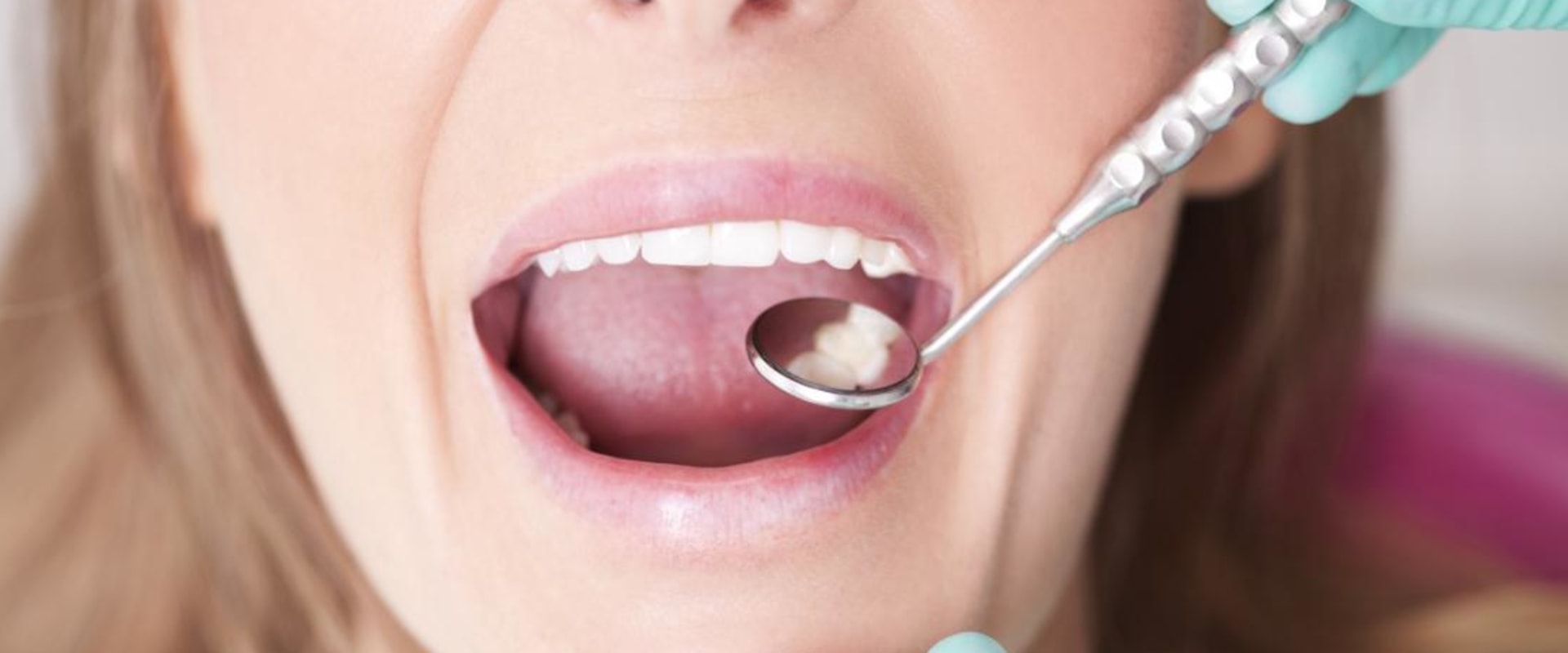 The Ultimate Guide to Dental Care