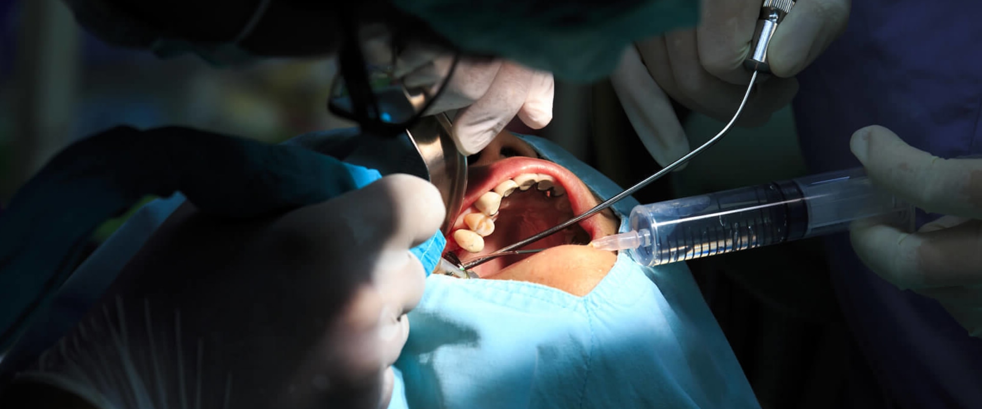 Why Dental Surgery is Essential for Oral Health