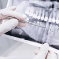 What is the Difference Between a Dentist and a Dental Clinic?