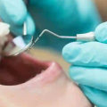 Where is the Best Dental Clinic Near Me?