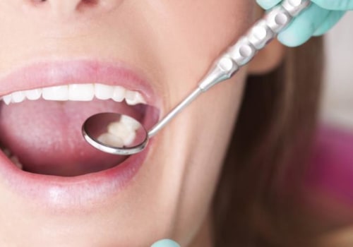 The Ultimate Guide to Dental Care